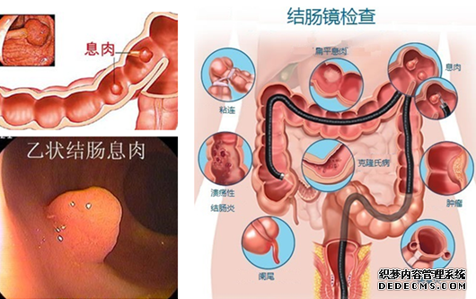 福州那里看肠道好