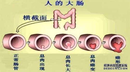 外疮为什么会痒